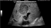 liver-start-image.jpg