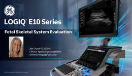 1-8-7 LOGIQ E10 Series Fetal Skeletal Evaluation