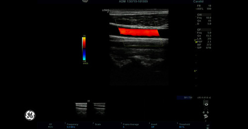 LOGIQ F-Series - Imaging modes and End Exam (EN)