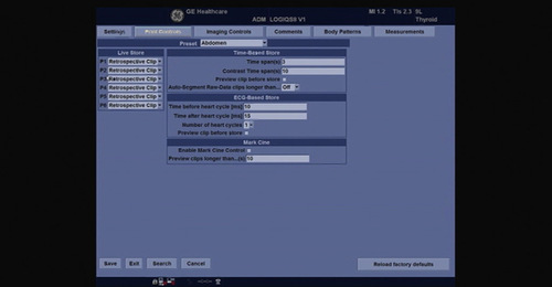 LOGIQ S8 - Print keys configuration