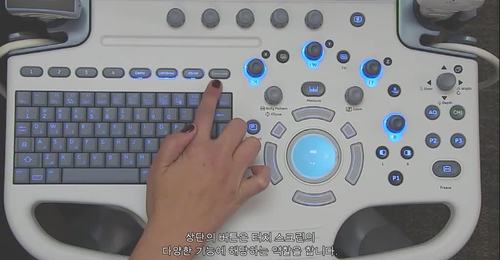 LOGIQ  S7 - Control Panel Overview