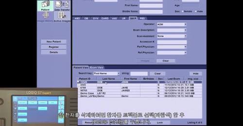 LOGIQ S7 - Deleting Studies from the Hard Drive