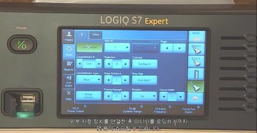 LOGIQ S7 - Importing Patient Studies