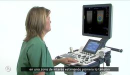 LOGIQ F-Series - Elastography (ES)