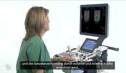 LOGIQ F-Series - Elastography (DE)