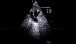 Vscan Case Study - Bedside echoscopy 