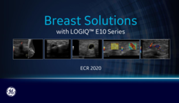 Breast Solutions with LOGIQ E10 Series – 2020