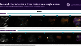 Poster - Liver lesions