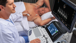 LOGIQ Ultrasound Cardiac Strain