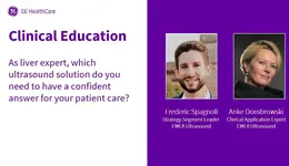 LIVER – As liver expert, which ultrasound solution do you need to have a confident answer for your patient care? - Frederic Spagnoli & Anke Dombrowski