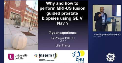 Why and how to perform MRI-US fusion guided prostate biopsies using GE V Nav? 7-years experience with Prof. Philippe Puech