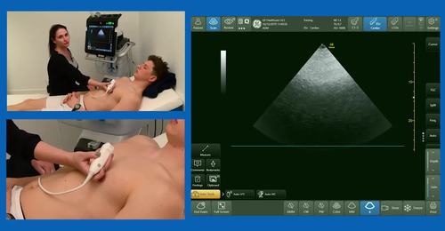 How to avoid common pitfalls in focused cardiac ultrasound with Prof. Sharon Kay