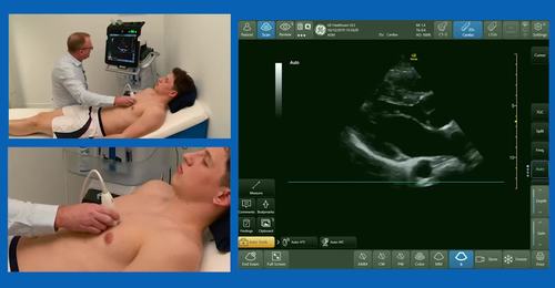 How to assess the right ventricle (FUSIC heart) with Dr. Marcus Peck