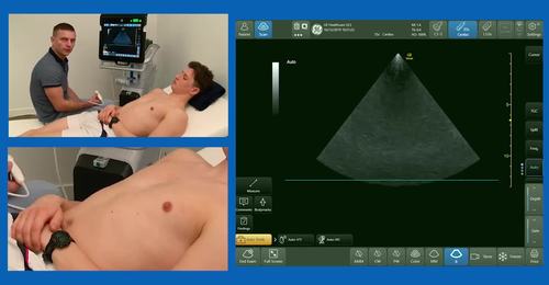 How to assess volume status (FUSIC heart) with Dr. Ashley ...