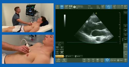 How to assess right heart pressures (FUSIC HD pressure part 1) with Dr. Ashley Miller