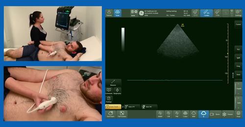 How to assess valves and the aorta (FUSIC HD flow part 2) ...