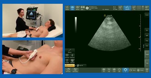 16 Steps - How to teach focused cardiac ultrasound view systematically ...