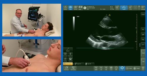 How to assess the left ventricle (FUSIC heart) with Dr. Marcus Peck