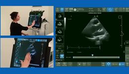 Assessment of ventricular function (FUSIC HD) with Prof. Sharon Kay