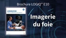 LOGIQ E10 Imagerie du foie Brochure FR