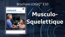 LOGIQ E10 Musculo-squelettique Brochure FR