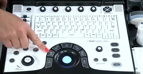 LOGIQ e - Trackball functions