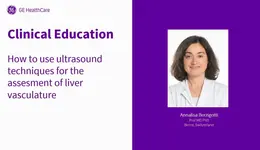 LIVER – How to use ultrasound techniques for the assessment of liver vasculature - Prof Dr Annalisa Berzigotti