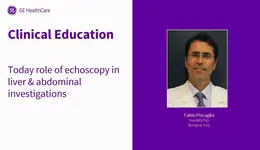 LIVER – Today role of echoscopy in liver & abdominal - Prof Dr Fabio Piscaglia