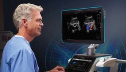 LOGIQ E10 Radiology