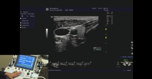 LOGIQ P9/P7- Measurements