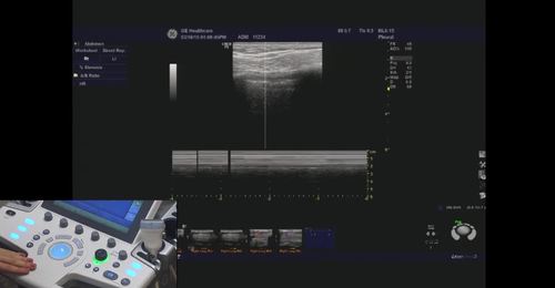 LOGIQ P9/P7- M-Mode controls