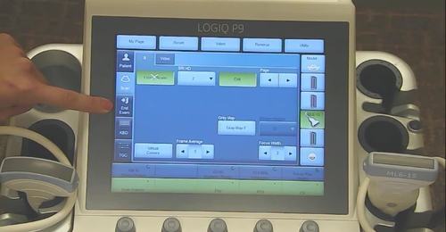 LOGIQ P9/P7- Touch panel overview