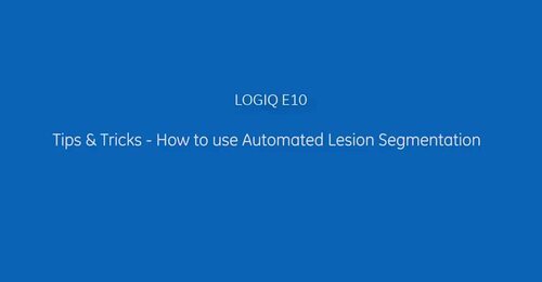 LOGIQ E10 Tips  Tricks How to use  Automated Lesion Segmentation