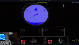 What is Cardiac Strain