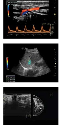 ultrasound-technology-expo-club-entry-2.jpg